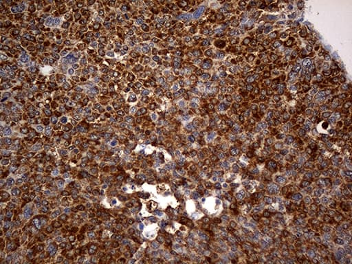RGS10 Antibody (clone OTI1B10)