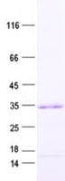 Human STPG1 Protein (Recombinant His, N-Terminal)