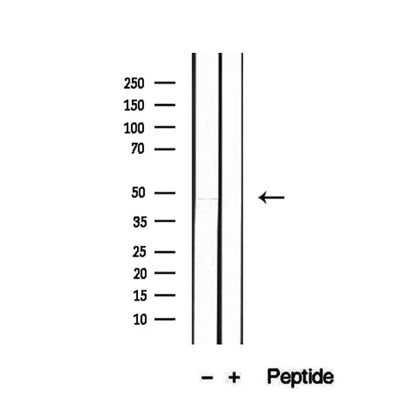 Polyclonal Rabbit anti-Human PAFAH2 Antibody (IHC, IF, WB)