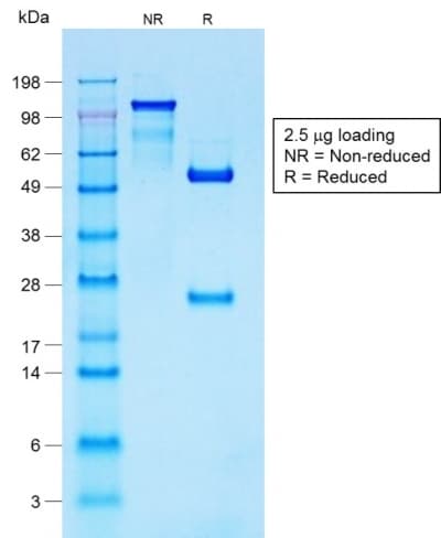 S100B / S100 Beta Antibody (clone S100B/1706R, Azide-free, Carrier-free)