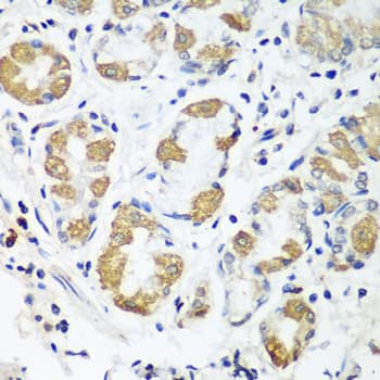 Polyclonal Rabbit anti-Human OXCT1 Antibody (IHC, WB)