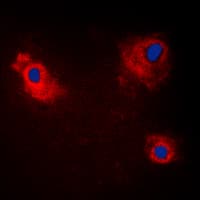 TANK Antibody (Internal)