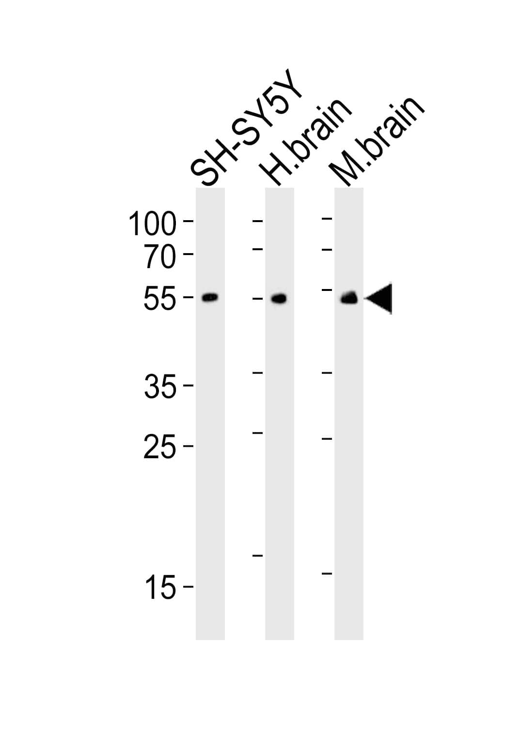CHRM2 / M2 Antibody (clone 1424CT461.78.60)