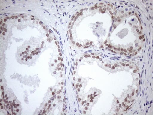 MGMT Antibody (clone OTI6C4)