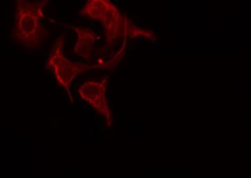 RPL12 / Ribosomal Protein L12 Antibody