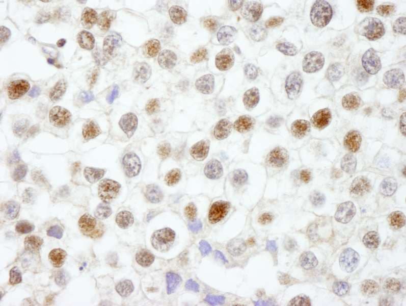 Polyclonal Rabbit anti-Human FEN1 Antibody (aa250-300, IHC)