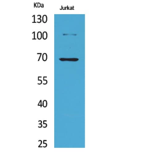 XRCC6 / Ku70 Antibody (acetylation site of K542.)