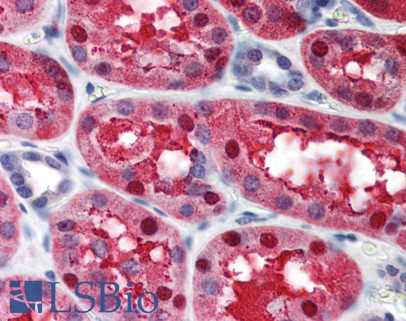 IHC-plus™ TIP120 / CAND1 Antibody (aa11-24)
