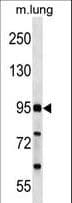 FCHO2 Antibody (aa137-165)