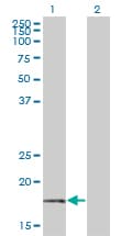 BTF3 Antibody (clone 3C4-2E11)