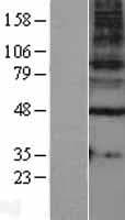 GABRG1 Protein (Over-Expression Lysate Myc-DDK (Flag))