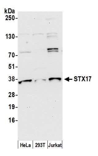 Polyclonal Rabbit anti-Human STX17 / Syntaxin 17 Antibody (aa150-200, WB)