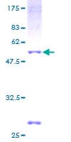 Human NME5 Protein (Recombinant GST)