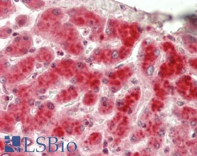 IHC-plus™ SRA1 / SRA Antibody (Internal)