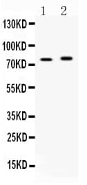 ACS5 / ACSL5 Antibody