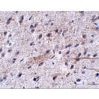 Polyclonal Rabbit anti-Human LRFN5 Antibody (IHC, WB)
