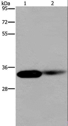 Polyclonal Rabbit anti-Human LIMS1 / PINCH Antibody (IHC, WB)