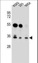 GLIPR1L2 Antibody (aa47-76)