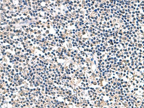 ATP5D Antibody