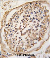 NPTX2 Antibody (aa 160-189, Internal)