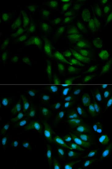 MAPK7 / ERK5 Antibody