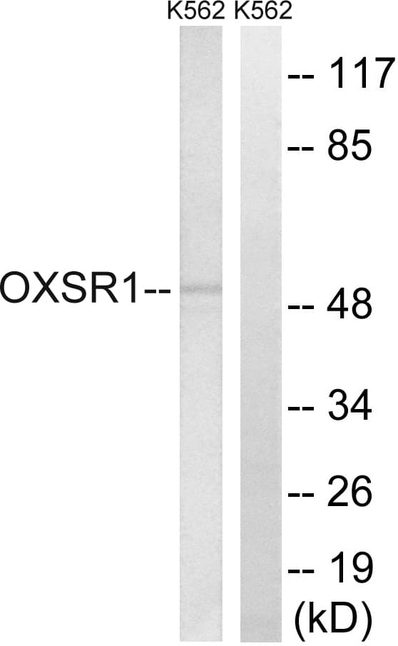 OXSR1 / OSR1 Antibody (aa272-321)
