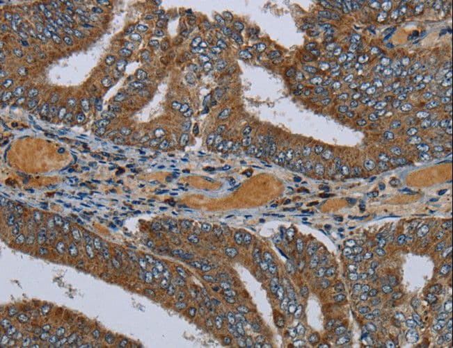 Polyclonal Rabbit anti-Human PCK2 / PEPCK Antibody (IHC, WB)