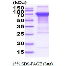 Human FURIN Protein (Recombinant His)