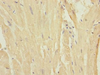 Polyclonal Rabbit anti-Human MYL7 Antibody (IHC, WB)