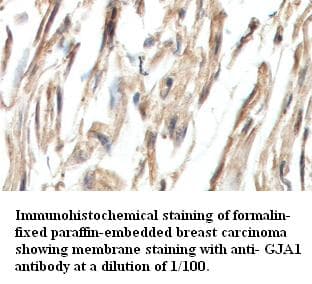Polyclonal Rabbit anti-Human GJA1 / CX43 / Connexin 43 Antibody (IHC, WB)