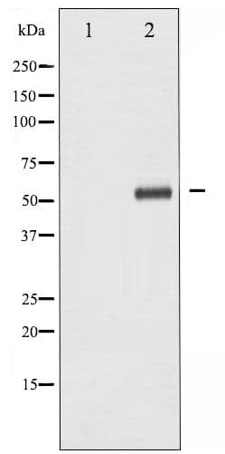 Polyclonal Rabbit anti-Human CHEK1 / CHK1 Antibody (IF, WB)