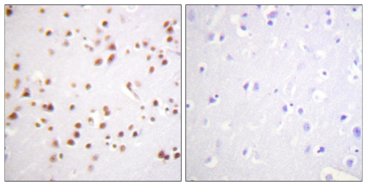 CTNND1 / p120 Catenin Antibody (p228)