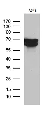 TGFBI Antibody (aa405-683, clone OTI9A11)