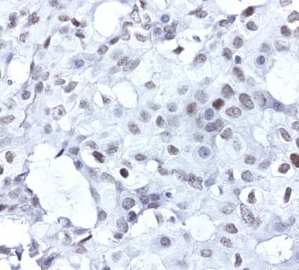 ERCC4 / XPF Antibody (clone UMAB22, Carrier-free)