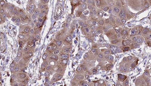 Polyclonal Rabbit anti-Human CA2 / Carbonic Anhydrase II Antibody (IHC, WB)