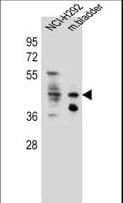 GHSR / Ghrelin Receptor Antibody (aa326-357)