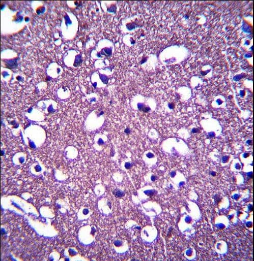 PCDHGA3 Antibody (aa284-311)