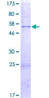 Human MRPL16 Protein (Recombinant GST)