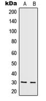IL5 Antibody (Internal)