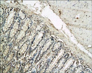 Polyclonal Rabbit anti-Human IL-1B / IL-1 Beta Antibody (IHC, WB)