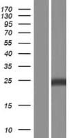 SOD2 / Mn SOD Protein (Over-Expression Lysate Myc-DDK (Flag))