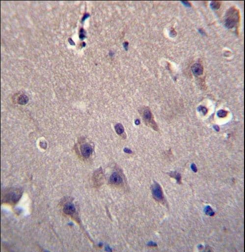 MCF2 / DBL Antibody (aa804-833)