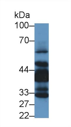 LIMS1 / PINCH Antibody (aa68-303, APC)