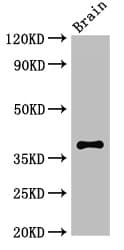Polyclonal Rabbit anti-Human CASP12 / Caspase 12 Antibody (IHC, IF, WB)