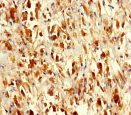 SARS / Serine-tRNA Ligase Antibody