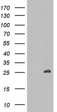 BCL2 / Bcl-2 Antibody (clone OTI2E5)