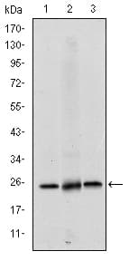 EIF4E Antibody (clone 5D11)