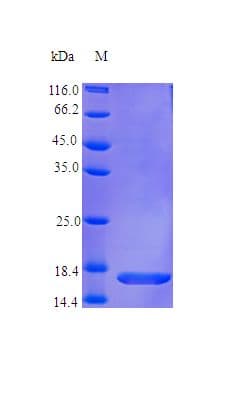 Human IL36RN / IL1F5 Protein (Recombinant)