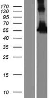 RASGRP4 Protein (Over-Expression Lysate Myc-DDK (Flag))