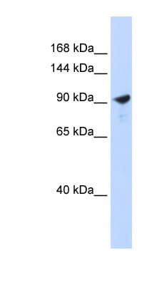 Polyclonal Rabbit anti-Human PAPPA2 / Pappalysin 2 Antibody (aa432-481, WB)